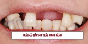 nam-mo-thay-rung-rang-danh-so-may