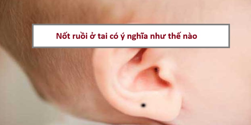 not-ruoi-o-tai-co-y-nghia-gi